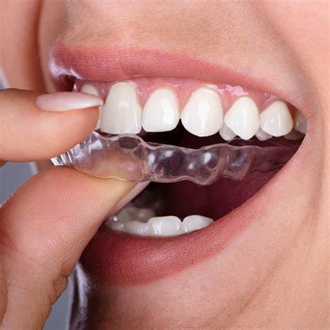 Orthodontics Treatment